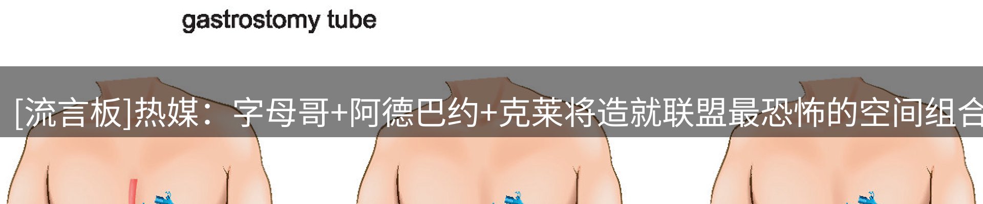 新闻追踪
